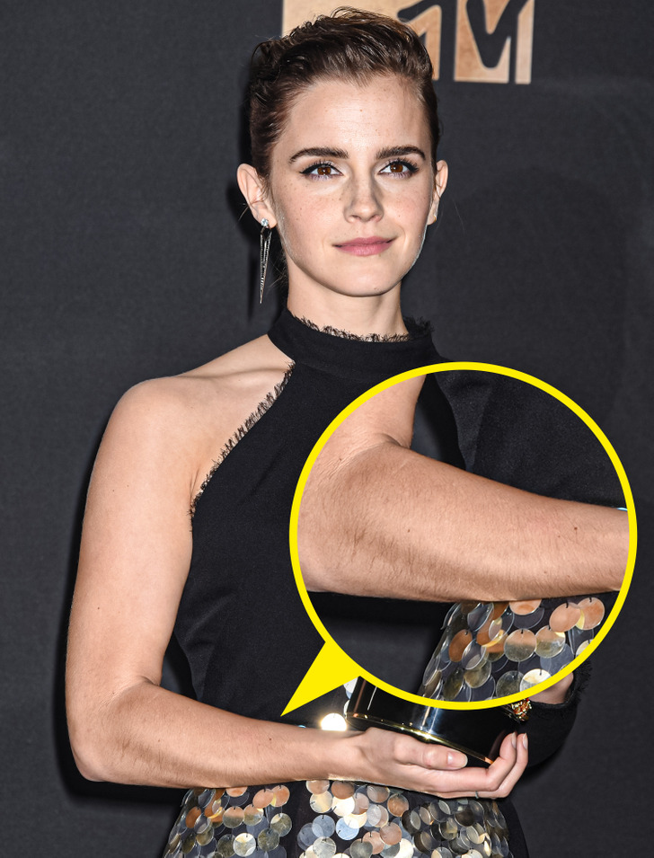 15 Famous Women Who Aren't Bothered by a Bit of Body Hair