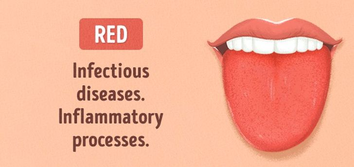 13 Things Your Tongue Is Trying to Tell You About Your Health