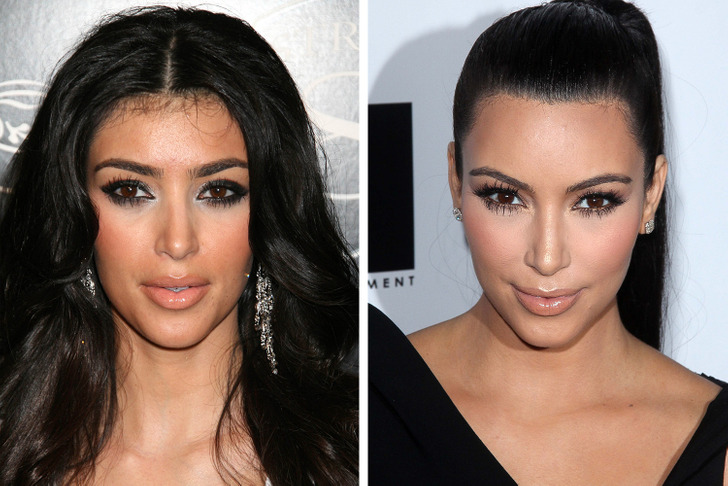 16 Celebrities Who Regretted Their Cosmetic Procedures