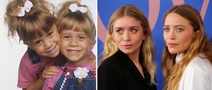 15 Beautiful Child Stars Who Totally Ruined Their Faces