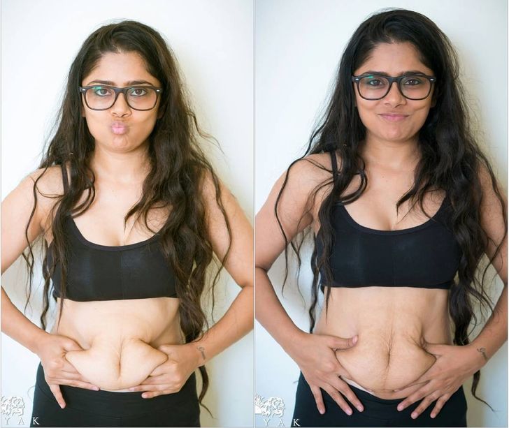 18 Women Who Showed Their Bodies After Pregnancy, and We’re Proud of Them