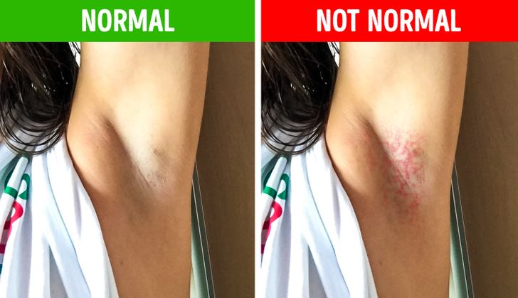 6 Armpit Signals That Can Indicate Health Issues