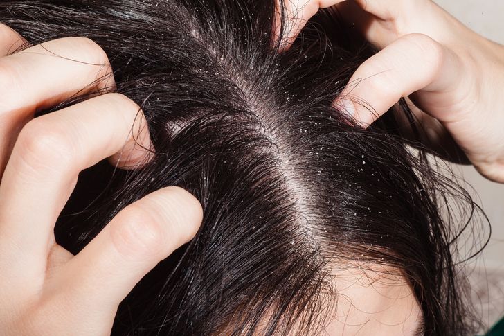 10 Mistakes to Avoid for a Healthy Scalp and Hair