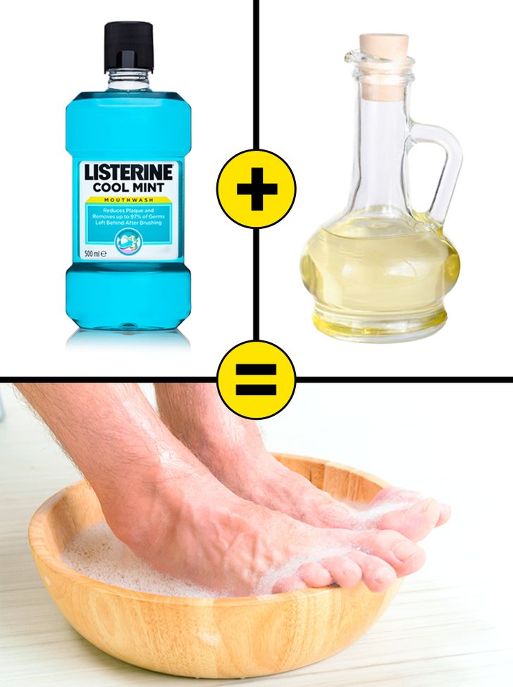 At-Home Treatment Options for Dry, Cracked Heels | Cone Health-hkpdtq2012.edu.vn