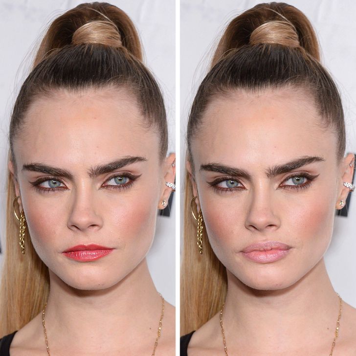 What Celebrities Would Look Like If They Got Popular Beauty Procedures Done