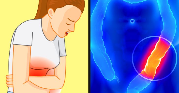 5 Reasons You Shouldn’t Hold In Your Fart, According to Science