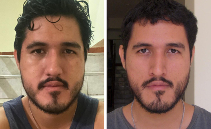 1c83675940a1f23cd1f9502f4f 13 Before-and-After Photos That Tell a Whole Story / Bright Side