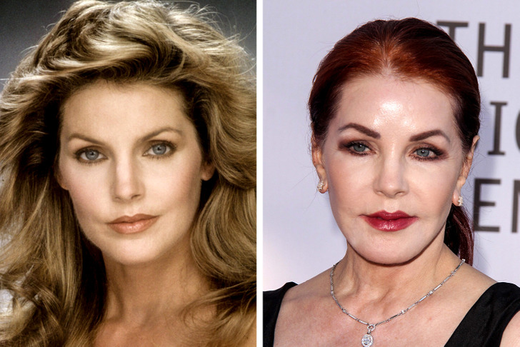 16 Celebrities Who Regretted Their Cosmetic Procedures