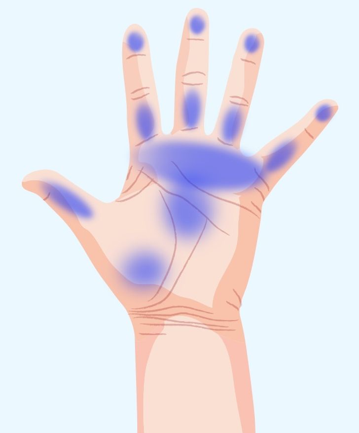 7 Important Things Your Hands Are Trying to Tell You About Your Health