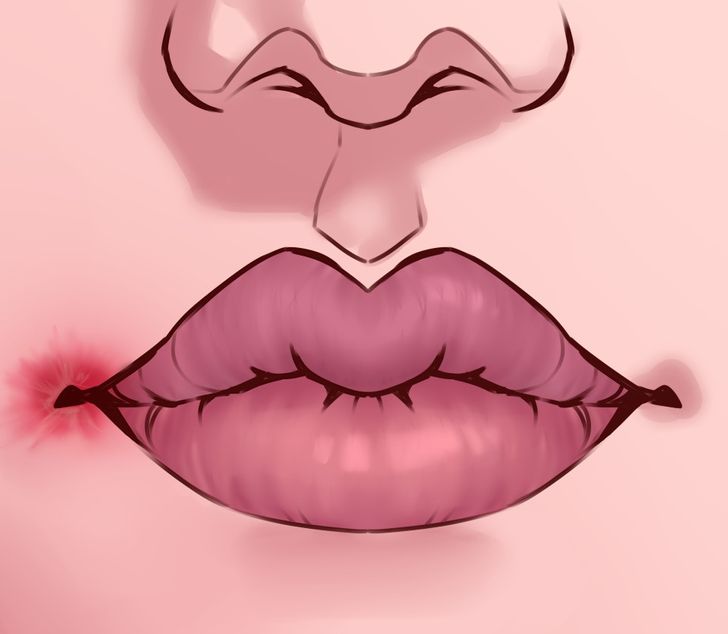 8 Things Your Lips Are Trying to Tell You About Your Health