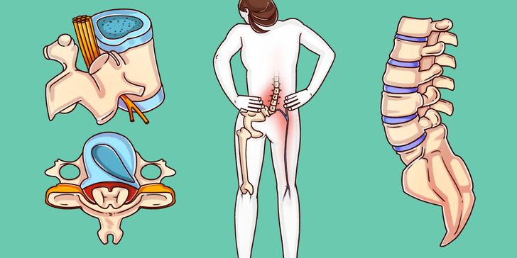 A Surgeon Reveals Exercises That Can Heal Your Spine Before It’s Too Late