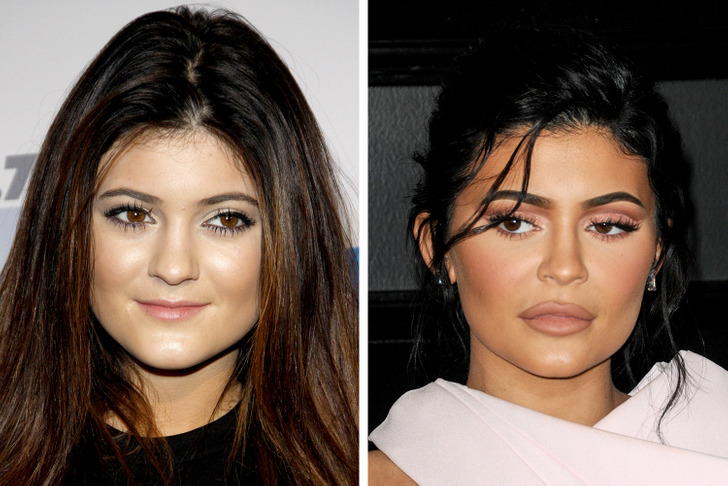 16 Celebrities Who Regretted Their Cosmetic Procedures