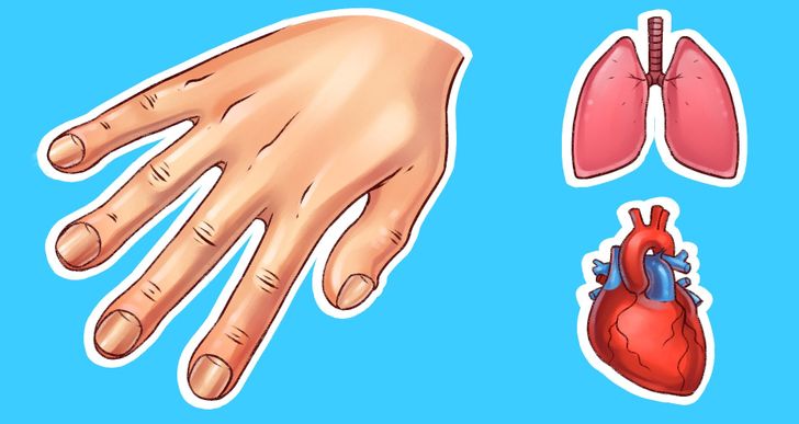 7 Things Your Hands Can Tell About Your Health