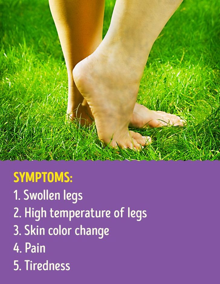 9 Leg Health Problems That Can Signal Serious Illnesses