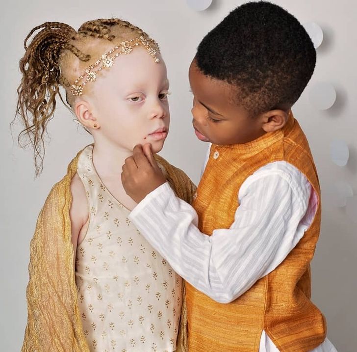 Twins With Different Skin Colors Astonished Their Mom When They Were ...