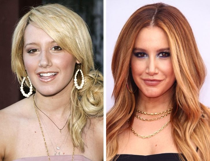 How Plastic Surgery Dramatically Changed These Celebrities