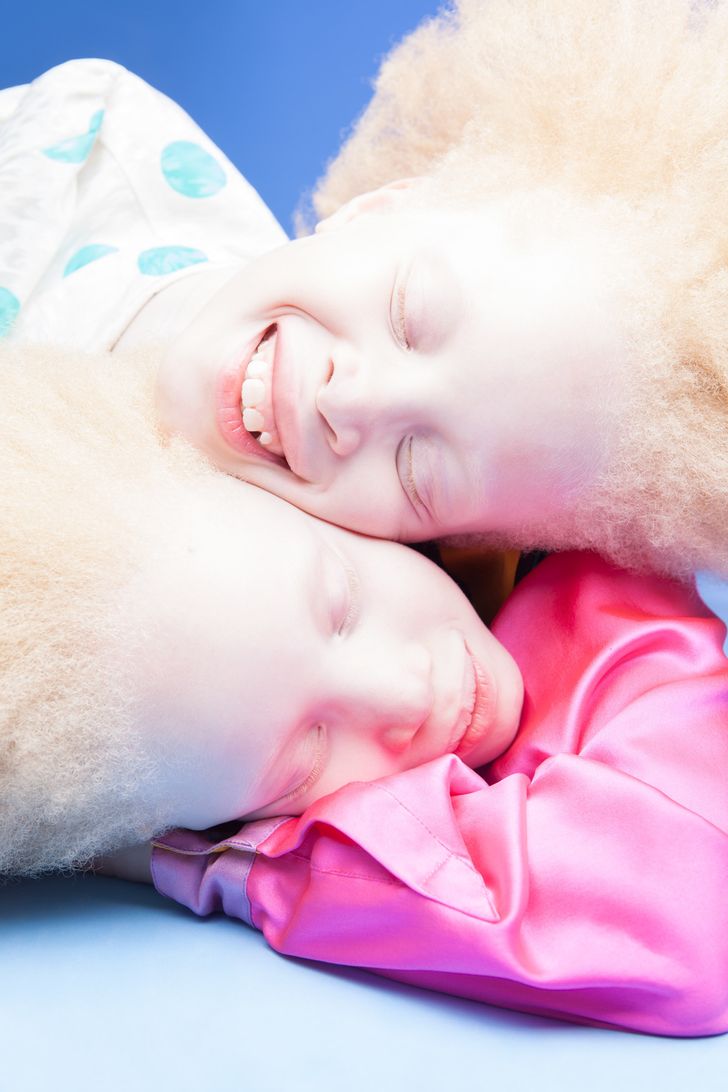 The Utterly Unique Appearance of These Twins Has Stunned the Internet