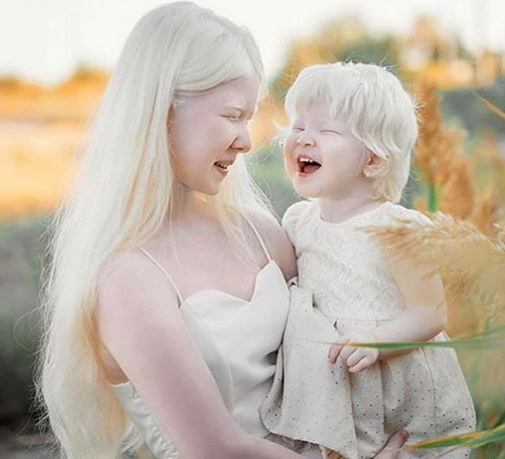 Albino Sisters Born 12 Years Apart Excite the Internet With Their Photos