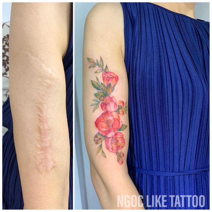 A Vietnamese Artist Uses Her Magical Touch to Help People Regain Self-Confidence by Covering Their Scars With Art