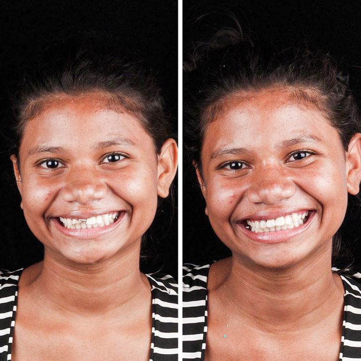 A Brazilian Dentist Travels the World to Return Smiles to the Faces of Poor People for Free