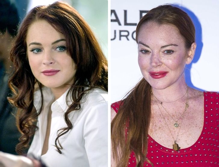 How Plastic Surgery Dramatically Changed These Celebrities