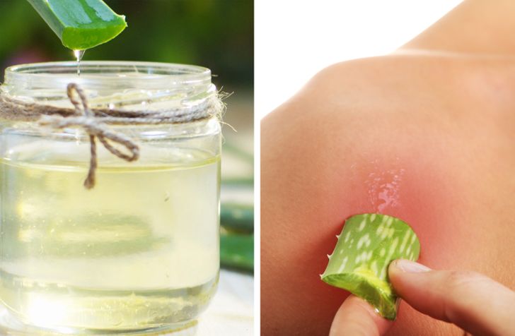 Itching Relief: The problem of itching will disappear in 10 minutes, do these easy home remedies