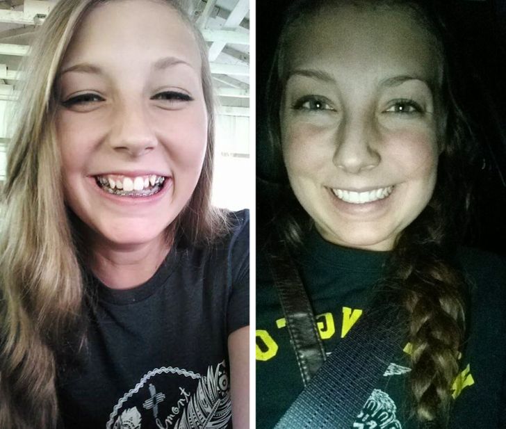 Internet Users Showed How Much Their Look Changed After They Fixed Just One Detail