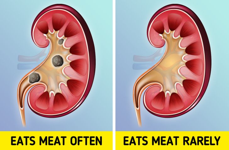 What Happens to Your Body When You Eat Too Much