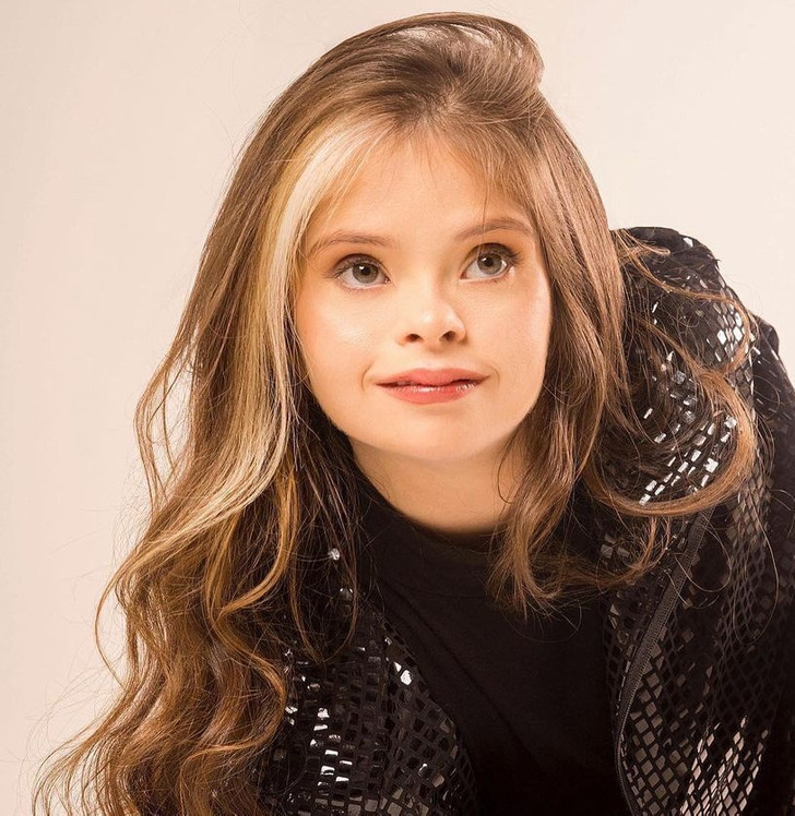 Jessica, a Model With Down Syndrome, Proves That Only You Can Define What Beauty Is