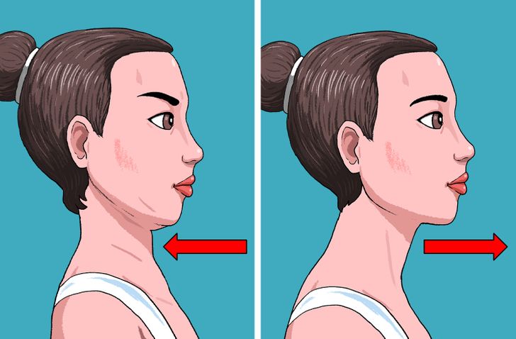 Receding chin exercises