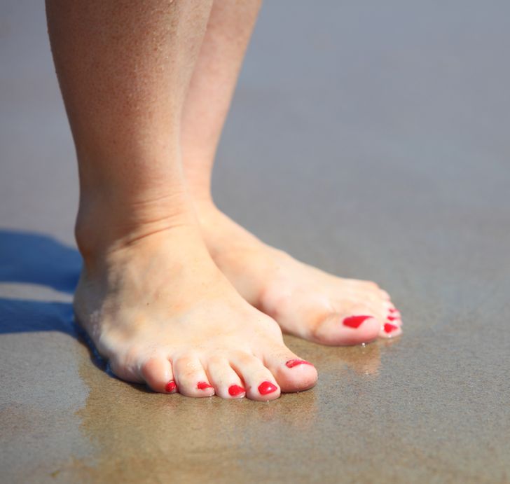 8 Ways to Ease Bunion Pain Naturally