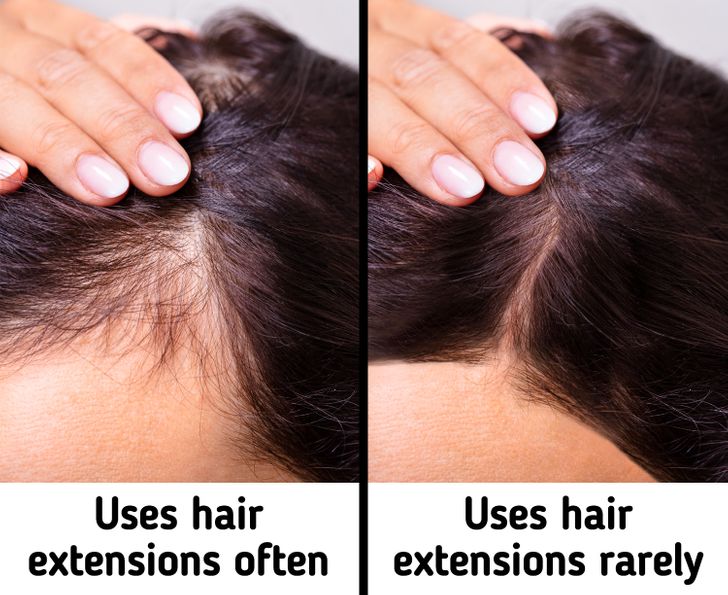 10 Mistakes to Avoid for a Healthy Scalp and Hair