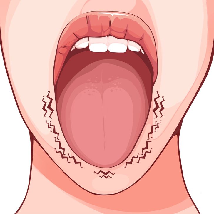 6 Things Your Tongue Can Reveal About Your Health