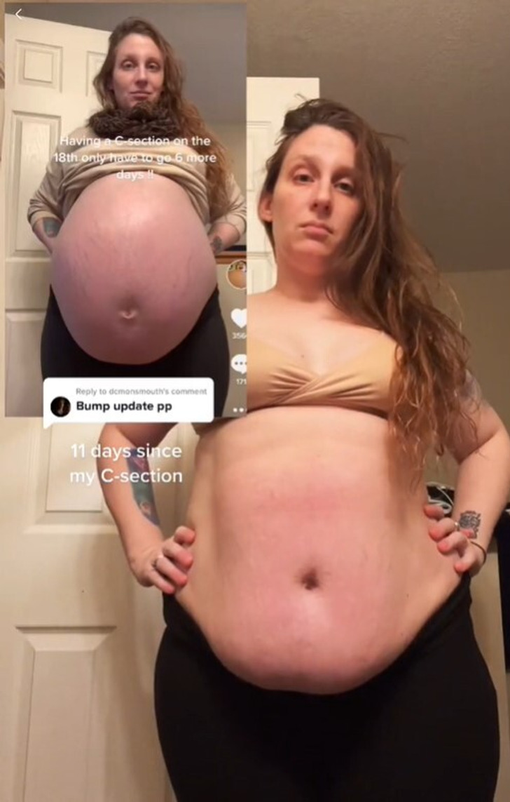 Mom's Huge Baby Bump Has People Guessing She's Having Eight Babies