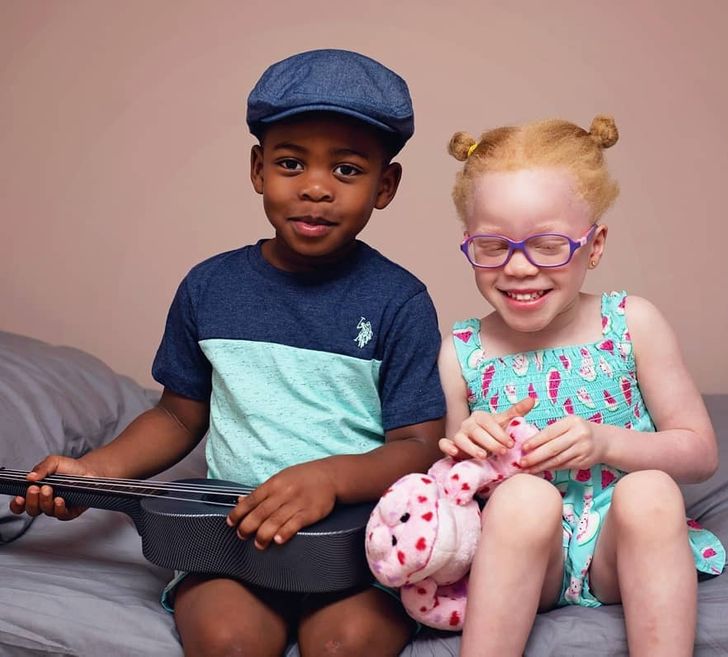 Twins With Different Skin Colors Astonished Their Mom When They Were Born