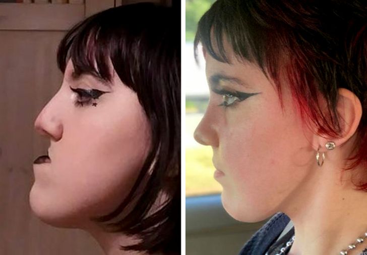 18 People Who Dared to Get Plastic Surgery and Hit the Jackpot