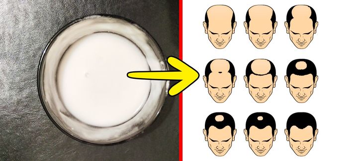 7 Superb and Quick Ways to Get Healthy and Shiny Hair