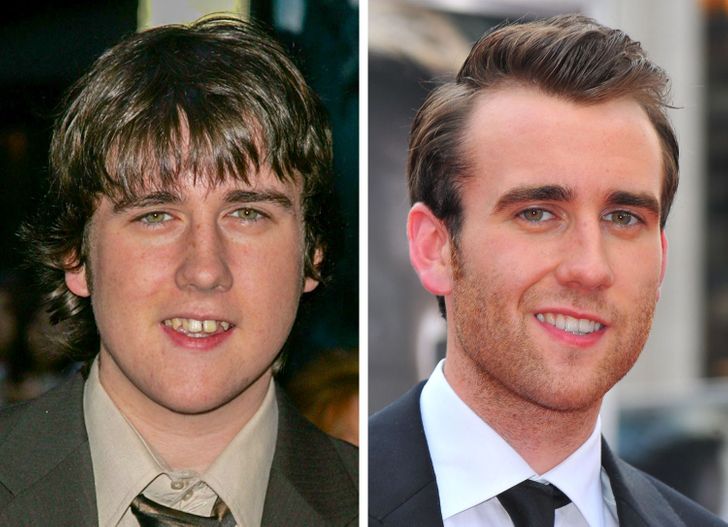 How the Smiles of 15 Celebrities Changed After They Fixed Their Teeth
