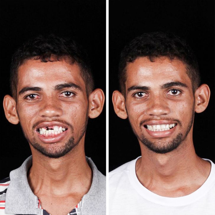 A Brazilian Dentist Travels the World to Return Smiles to the Faces of Poor People for Free
