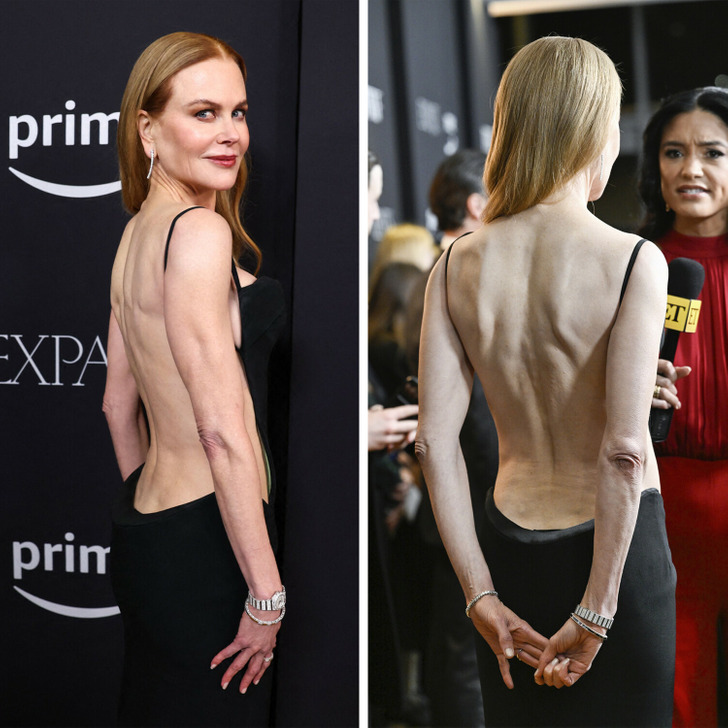 Nicole Kidman's Backless Little Black Dress Was Drama Galore