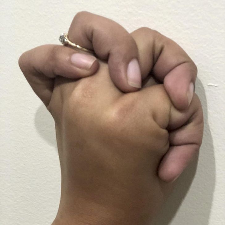 22 foto absurde ku gjithçka duket e gabuar