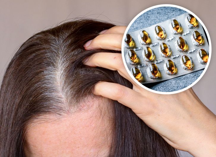 10 Remedies That Might Treat and Prevent Gray Hair