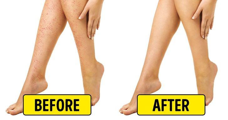 10 Natural Remedies for Irritation After Shaving