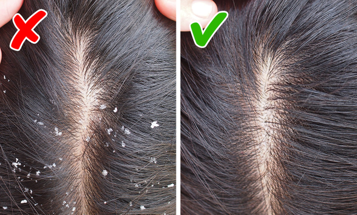 6 Ways to Regrow Hair Naturally and Combat Hair Loss