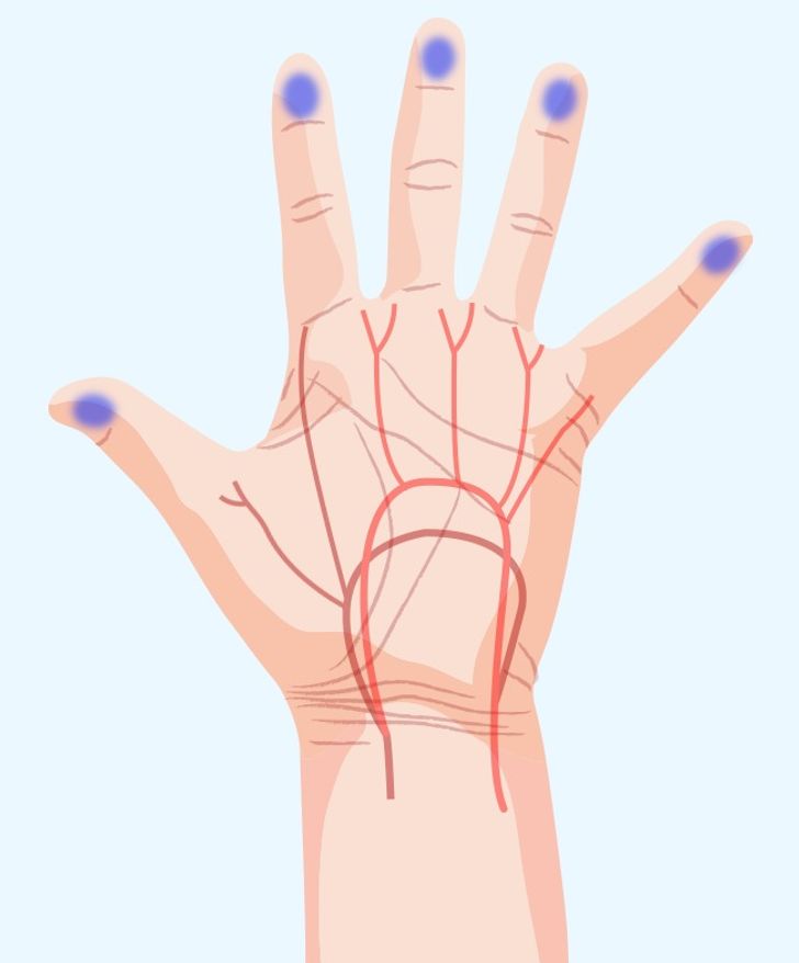 7 Important Things Your Hands Are Trying to Tell You About Your Health