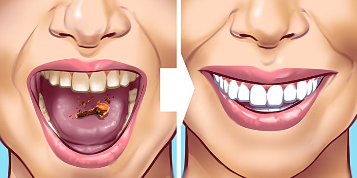 10 Ways To Remove Tartar Stains From Your Teeth