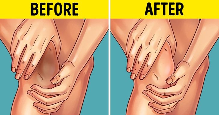 10 Natural Tricks to Remove Dark Knees and Elbows