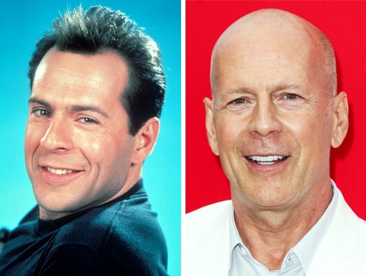 How These 12 Famous Actors Looked Before Going Bald