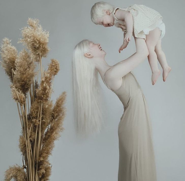 Albino Sisters Born 12 Years Apart Excite the Internet With Their Photos