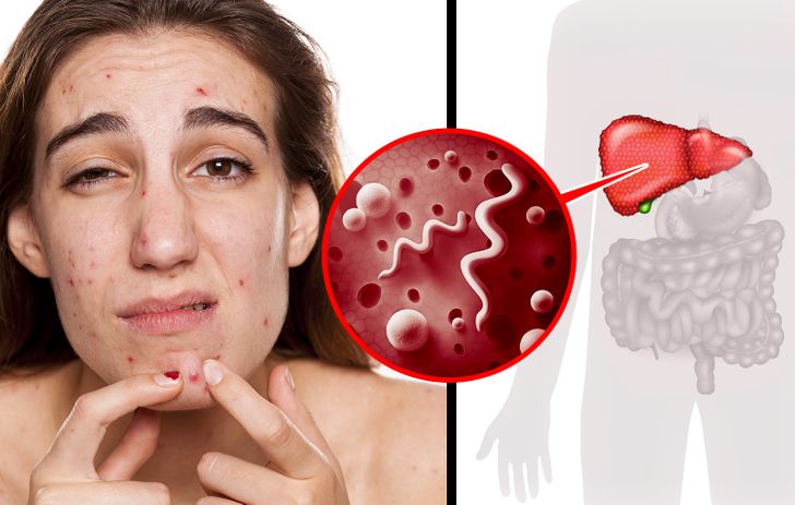 10 Signs Your Body Needs to Detox Really Bad